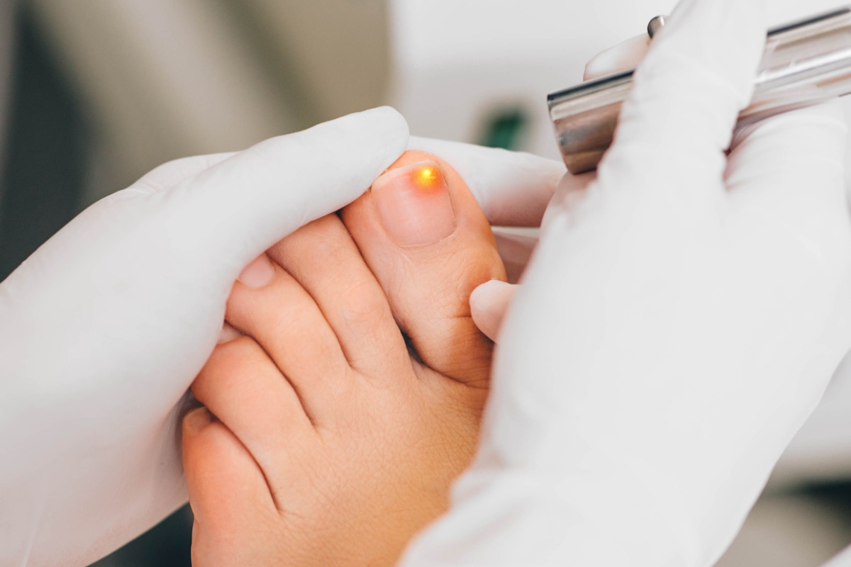 Broken Toe Treatment | X-ray | Podiatrist in Spring, TXLouetta Foot & Ankle  Specialists